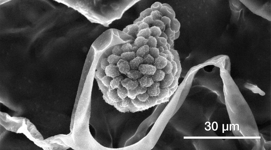 Biological samples (mold spores)-by-quattro-esem