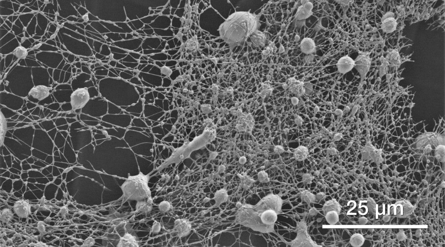 Soft materials (polymeric fibers) by quattro esem